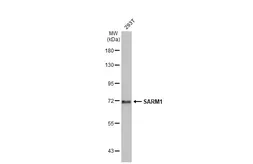 Anti-SARM1 antibody used in Western Blot (WB). GTX131411