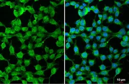 Anti-SARM1 antibody used in Immunocytochemistry/ Immunofluorescence (ICC/IF). GTX131411