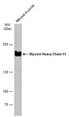 Anti-Myosin Heavy Chain 11 antibody used in Western Blot (WB). GTX131414