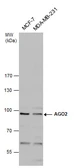 Anti-EIF2C2 antibody used in Western Blot (WB). GTX131422