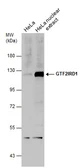 Anti-GTF2IRD1 antibody used in Western Blot (WB). GTX131433