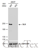 Anti-SLK antibody used in Western Blot (WB). GTX131438