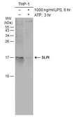Anti-SLPI antibody used in Western Blot (WB). GTX131447