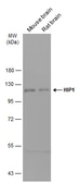 Anti-HIP1 antibody used in Western Blot (WB). GTX131449