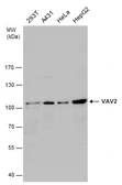 Anti-VAV2 antibody used in Western Blot (WB). GTX131451