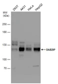 Anti-DAB2IP antibody used in Western Blot (WB). GTX131468