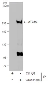Anti-ATG2A antibody used in Immunoprecipitation (IP). GTX131503