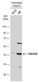 Anti-TMEM49 antibody used in Western Blot (WB). GTX131510