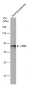 Anti-HRG antibody used in Western Blot (WB). GTX131514