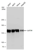 Anti-LATS1 antibody used in Western Blot (WB). GTX131532
