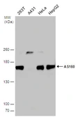 Anti-AS160 / TBC1D4 antibody used in Western Blot (WB). GTX131536