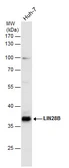 Anti-LIN28B antibody used in Western Blot (WB). GTX131546