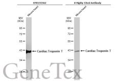 Anti-Cardiac Troponin T antibody used in Western Blot (WB). GTX131562