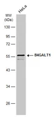 Anti-B4GALT1 antibody used in Western Blot (WB). GTX131598