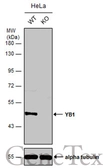 Anti-YB1 antibody used in Western Blot (WB). GTX131630
