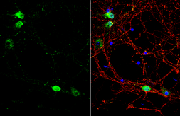 Anti-VAPB antibody used in Immunocytochemistry/ Immunofluorescence (ICC/IF). GTX131631