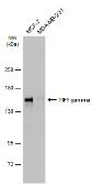 Anti-TIF1 gamma antibody used in Western Blot (WB). GTX131686