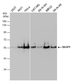 Anti-BASP1 antibody used in Western Blot (WB). GTX131728
