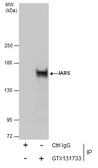 Anti-IARS antibody used in Immunoprecipitation (IP). GTX131733