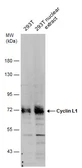 Anti-Cyclin L1 antibody used in Western Blot (WB). GTX131754