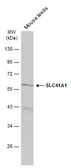 Anti-SLC41A1 antibody used in Western Blot (WB). GTX131796
