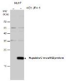 Anti-Hepatitis C virus NS2 protein antibody used in Western Blot (WB). GTX131832