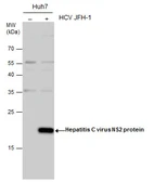 Anti-Hepatitis C virus NS2 protein antibody used in Western Blot (WB). GTX131832
