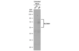 Anti-SLC38A1 antibody used in Western Blot (WB). GTX131854