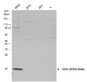 Anti-West Nile virus NS4A protein antibody used in Western Blot (WB). GTX131957