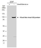 Anti-West Nile virus NS5 protein antibody used in Western Blot (WB). GTX131961