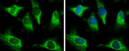 Anti-Pyruvate Carboxylase antibody used in Immunocytochemistry/ Immunofluorescence (ICC/IF). GTX131987