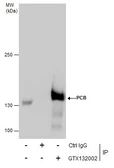 Anti-Pyruvate Carboxylase antibody used in Immunoprecipitation (IP). GTX132002