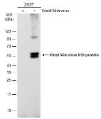 Anti-West Nile virus NS1 protein antibody used in Western Blot (WB). GTX132053