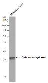 Anti-Carbonic Anhydrase 1 antibody used in Western Blot (WB). GTX132070