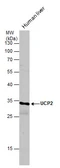 Anti-UCP2 antibody used in Western Blot (WB). GTX132072