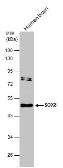 Anti-SOX8 antibody used in Western Blot (WB). GTX132075