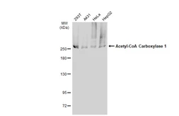 Anti-Acetyl-CoA Carboxylase 1 antibody used in Western Blot (WB). GTX132081