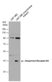 Anti-Dopamine Receptor D4 antibody used in Western Blot (WB). GTX132084