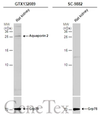 Anti-Aquaporin 2 antibody used in Western Blot (WB). GTX132089