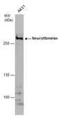 Anti-Neurofibromin antibody used in Western Blot (WB). GTX132099