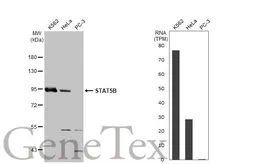 Anti-STAT5B antibody used in Western Blot (WB). GTX132113