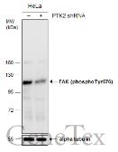 Anti-FAK (phospho Tyr576) antibody used in Western Blot (WB). GTX132140