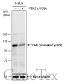 Anti-FAK (phospho Tyr576) antibody used in Western Blot (WB). GTX132140