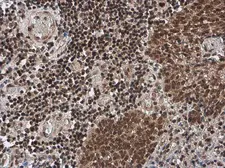 Anti-ATM (phospho Ser1981) antibody used in IHC (Paraffin sections) (IHC-P). GTX132146