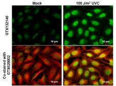 Anti-ATM (phospho Ser1981) antibody used in Immunocytochemistry/ Immunofluorescence (ICC/IF). GTX132146