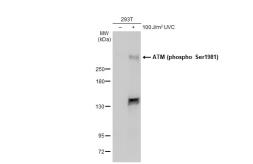 Anti-ATM (phospho Ser1981) antibody used in Western Blot (WB). GTX132146