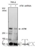 Anti-ATM antibody used in Western Blot (WB). GTX132147