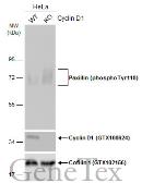 Anti-Paxillin (phospho Tyr118) antibody used in Western Blot (WB). GTX132152