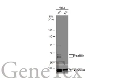 Anti-Paxillin antibody used in Western Blot (WB). GTX132153