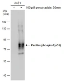 Anti-Paxillin (phospho Tyr31) antibody used in Western Blot (WB). GTX132154
